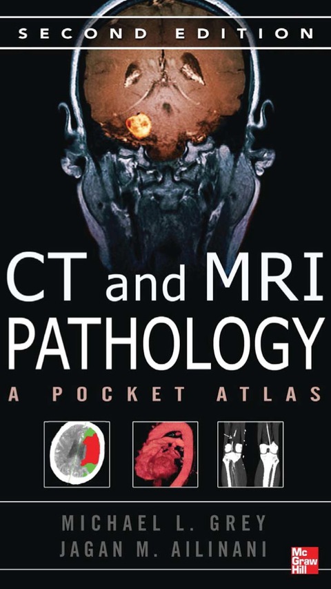 Book CT & MRI Pathology: A Pocket Atlas, Second Edition free