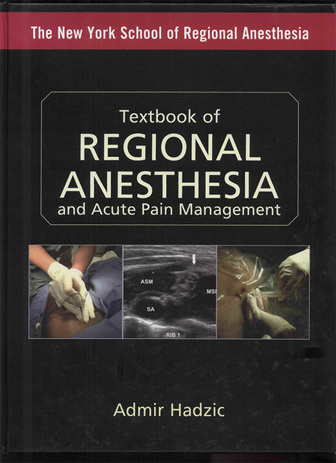 Book Textbook of Regional Anesthesia and Acute Pain Management (Hadzic, Textbook of Regional Anesthesia and Acute Pain Management) free