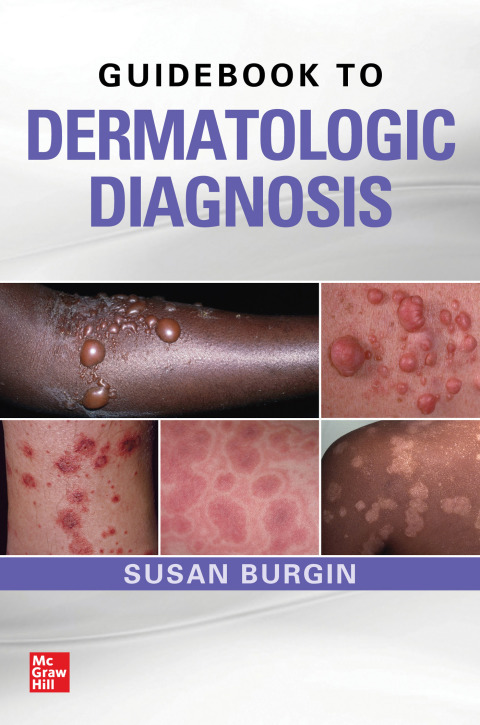 Book Guidebook to Dermatologic Diagnosis free