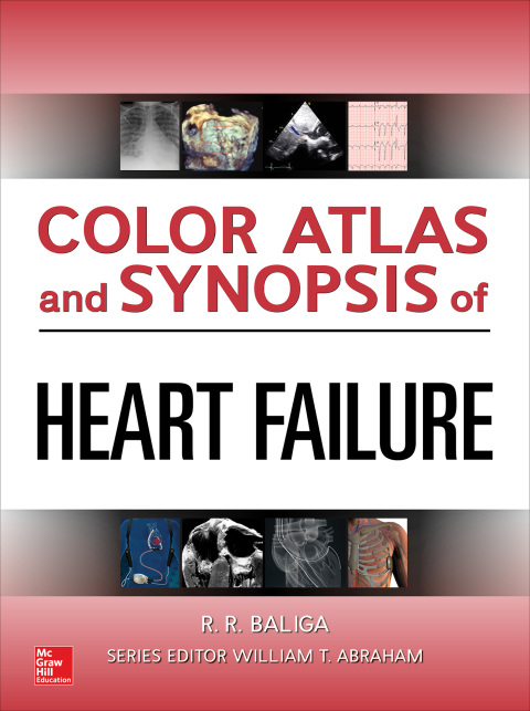 Book Color Atlas and Synopsis of Heart Failure free