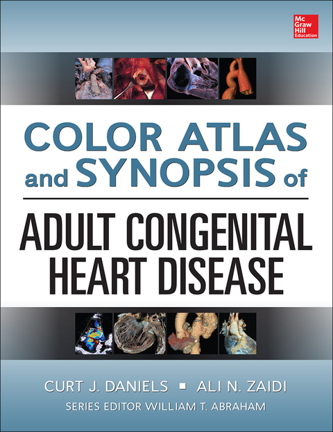 Book Color Atlas and Synopsis of Adult Congenital Heart Disease free