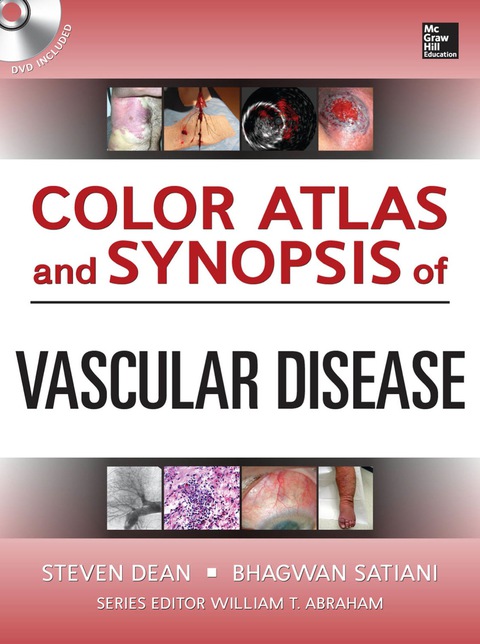 Book Color Atlas and Synopsis of Vascular Disease free