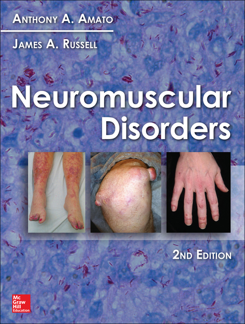 Book Neuromuscular Disorders, 2nd Edition free