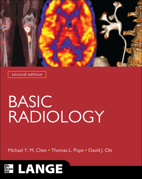 Book Basic Radiology, Second Edition (LANGE Clinical Medicine) free