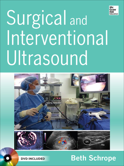 Book Surgical and Interventional Ultrasound free