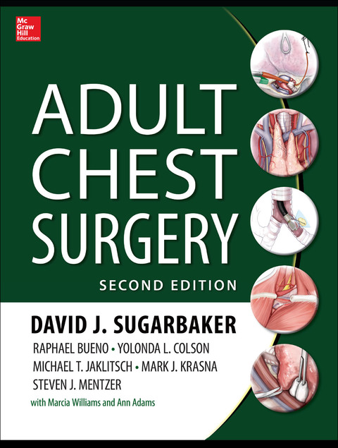 Book Adult Chest Surgery, 2nd edition free