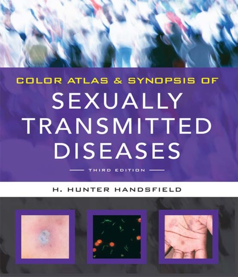 Book Color Atlas & Synopsis of Sexually Transmitted Diseases, Third Edition (Handsfield, Color Atlas & Synopsis of Sexually Transmitted Diseases) free