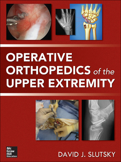 Book Operative Orthopedics of the Upper Extremity free