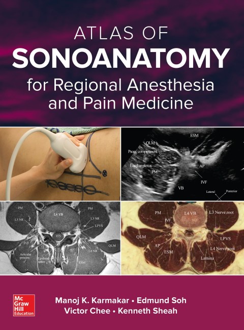Book Atlas of Sonoanatomy for Regional Anesthesia and Pain Medicine free