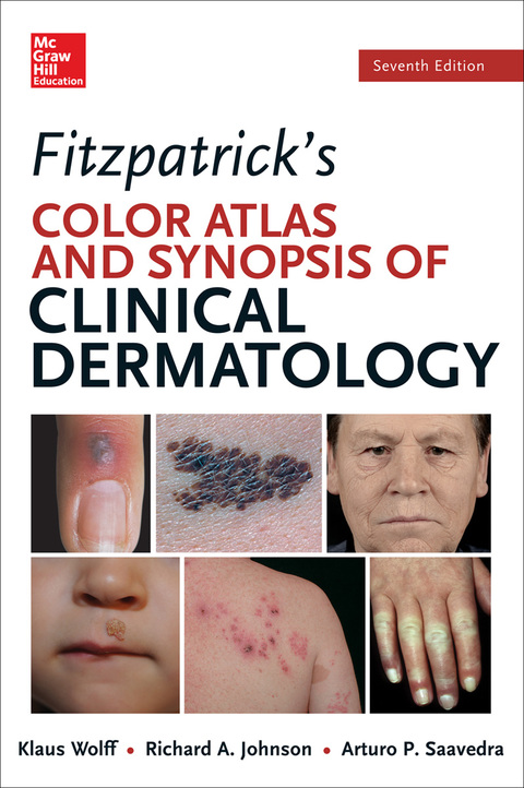 Book Fitzpatricks Color Atlas and Synopsis of Clinical Dermatology, Seventh Edition (Color Atlas & Synopsis of Clinical Dermatology (Fitzpatrick)) free