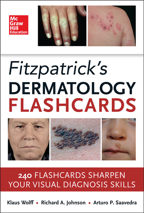 Book Fitzpatricks Dermatology Flash Cards free