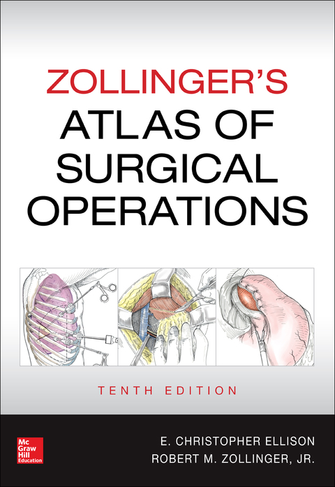 Book Zollinger's Atlas of Surgical Operations, Tenth Edition free
