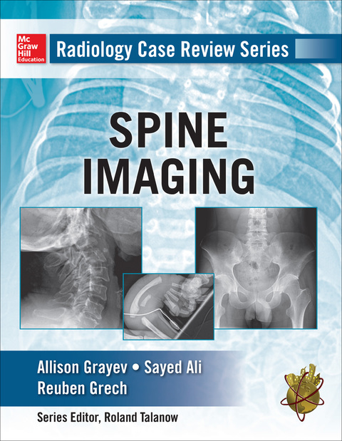 Book Radiology Case Review Series: Spine free