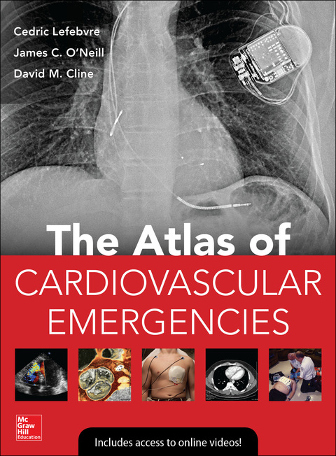 Book Atlas of Cardiovascular Emergencies free