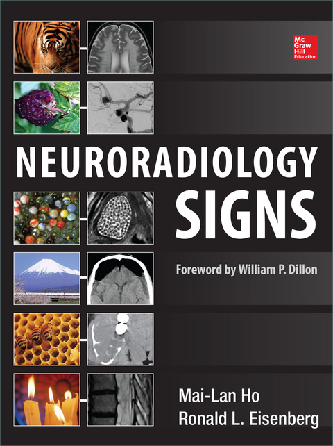 Book Neuroradiology Signs free