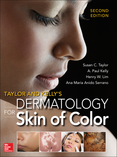 Book Taylor and Kelly's Dermatology for Skin of Color 2/E free