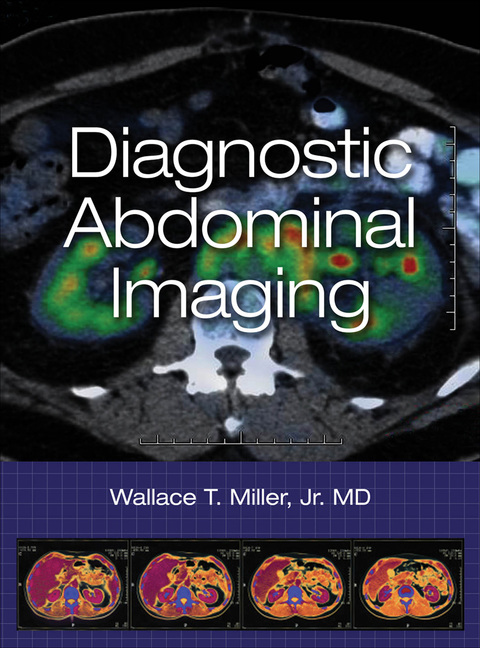 Book Diagnostic Abdominal Imaging free
