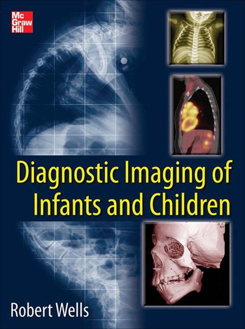 Book Diagnostic Imaging of Infants and Children free