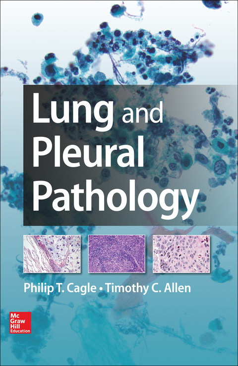 Book Lung and Pleural Pathology free