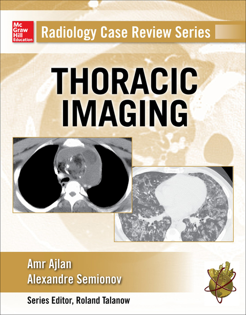 Book Radiology Case Review Series: Thoracic Imaging free
