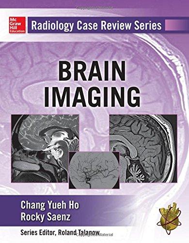Book Radiology Case Review Series: Brain Imaging free