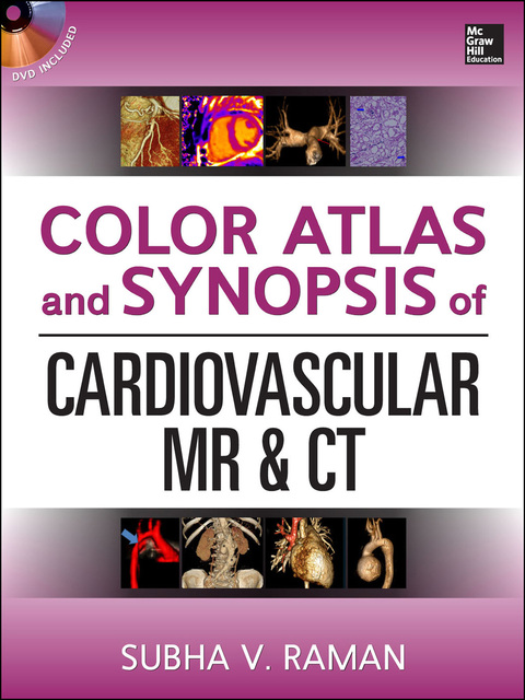 Book Color Atlas and Synopsis of Cardiovascular MR and CT (SET 2) free