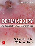 Book Dermoscopy: An Illustrated Self-Assessment Guide, 2/e free