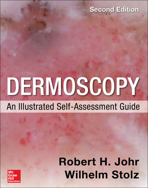 Book Dermoscopy: An Illustrated Self-Assessment Guide, 2/e free