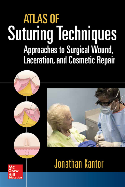 Book Atlas of Suturing Techniques: Approaches to Surgical Wound, Laceration, and Cosmetic Repair free