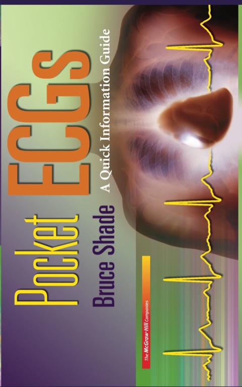 Book Pocket ECGs: A Quick Information Guide free