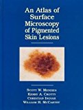 Book An Atlas Of The Surface Microscopy Of Pigmented Skin Tumors free