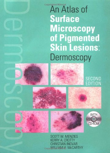 Book An Atlas Of Surface Microscopy Of Pigmented Skin Lesions: Dermoscopy,  Second Edition free