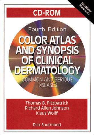 Book Color Atlas and Synopsis of Clinical Dermatology: Common and Serious Diseases free