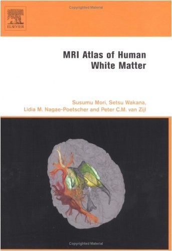Book MRI Atlas of Human White Matter free