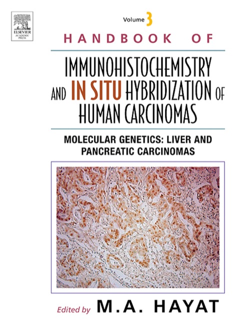 Book Handbook of Immunohistochemistry and in situ Hybridization of Human Carcinomas: Molecular Genetics: Liver and Pancreatic Carcinomas V3 free