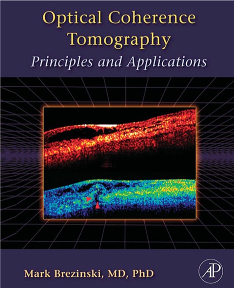 Book Optical Coherence Tomography: Principles and Applications free