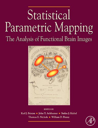 Book Statistical Parametric Mapping: The Analysis of Functional Brain Images free