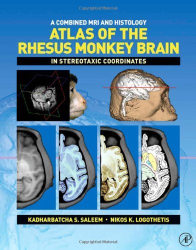 Book A Combined MRI and Histology Atlas of the Rhesus Monkey Brain in Stereotaxic Coordinates free