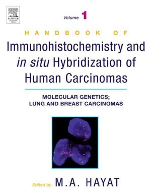 Book Handbook of Immunohistochemistry and in Situ Hybridization of Human Carcinomas free