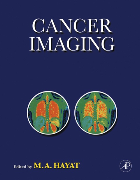 Book Cancer Imaging free