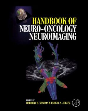 Book Handbook of Neuro-Oncology Neuroimaging free