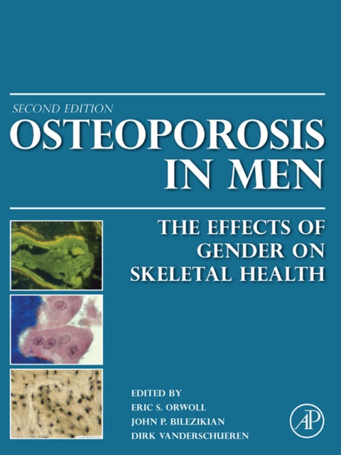 Book Osteoporosis in Men: The Effects of Gender on Skeletal Health free