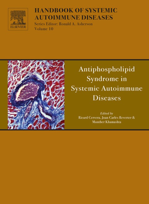 Book Antiphospholipid Syndrome in Systemic Autoimmune Diseases (ISSN Book 10) free
