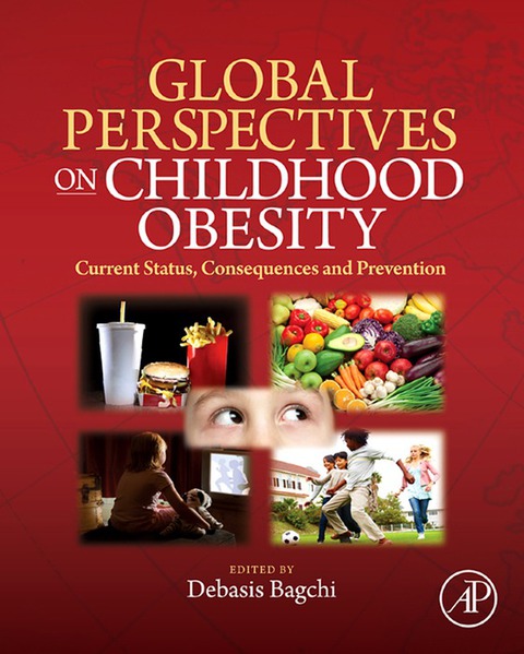 Book Global Perspectives on Childhood Obesity: Current Status, Consequences and Prevention free