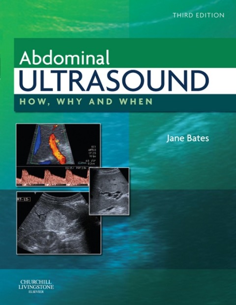 Book Abdominal Ultrasound: How, Why and When free