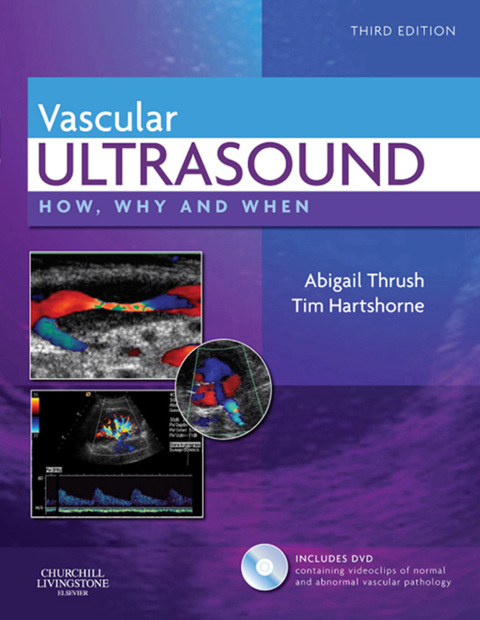 Book Vascular Ultrasound E-Book: How, Why and When free