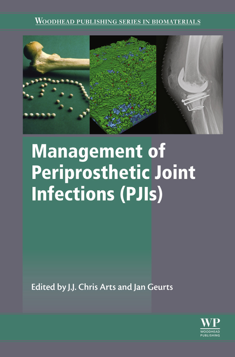 Book Management of Periprosthetic Joint Infections (PJIs) free