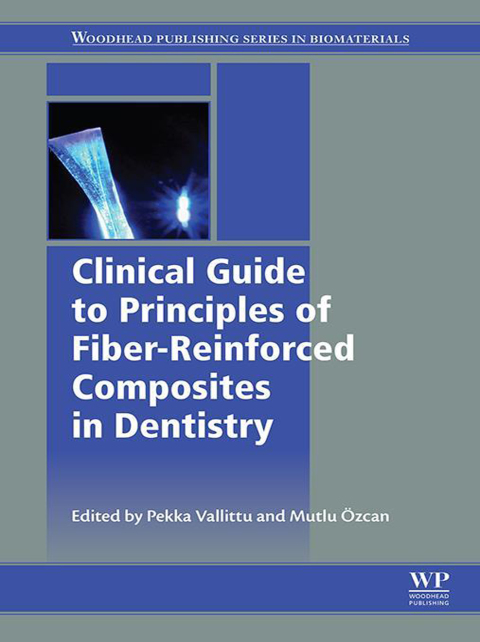 Book Clinical Guide to Principles of Fiber-Reinforced Composites in Dentistry free