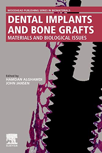 Book Dental Implants and Bone Grafts: Materials and Biological Issues free