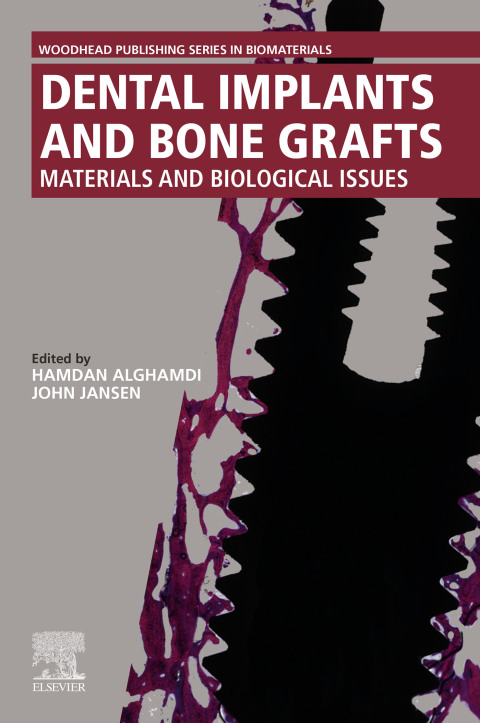 Book Dental Implants and Bone Grafts: Materials and Biological Issues free